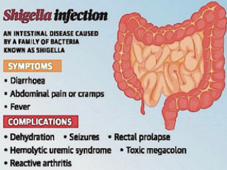 Kerala Shigella Outbreak Reported : केरळम्‌मध्ये ‘शिगेला’ संसर्गामुळे एका मुलाचा मृत्यू, १२६ जणांना लागण !
