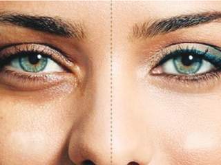 डोळ्यांखालील काळे डाग घालवण्यासाठी काय कराल ?