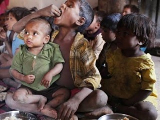 मेळघाटात २१ आदिवासी बालकांना जन्मजात हृदयरोग !